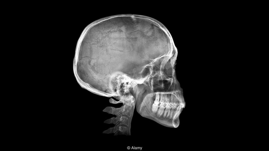 cranio humano